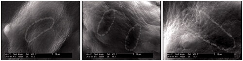 Figure 7. Connection between stem cells in SSCs colonies in SACS group. The dashed lines in the image show the connection of two cells in the colony.