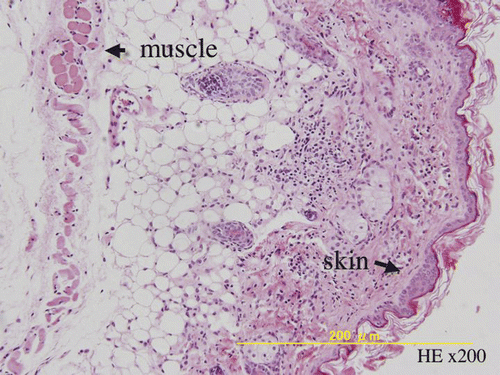 Figure 5. HE sections from group 3 showing no residual tumour 8 weeks after treatment.