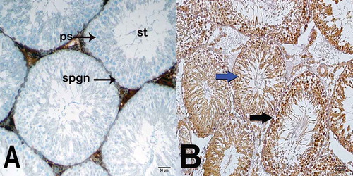 Figure 3. Light microscopy image of Caspase-3 staining. (A) (x400). Unirradiated group sections show normal spermatogonium (spgn) and primary spermatocytes (ps). Seminiferous tubule (st). (B) (x400). Irradiated group sections show Caspase-3-positive spermatogonium (black arrow) and primary spermatocytes (blue arrow).