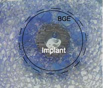 Figure 4. Manually drawn region of interest (ROI) 2.45 mm from the implant surface, shown by the complete circle. BGE, implant with porous coating of beads. The circle with the dashed line shows the approximate position of the drill hole. 1.25× objective.