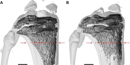 Figure 1 Micro-computed tomography images.Notes: (A) Tibia control and (B) tibia from ovariectomized rat (OVX) 14 weeks after bilateral OVX. The tibia from the OVX rat shows ~50% less bone volume compared to control; measurements were taken 2 mm away from the epiphyseal plate (indicated by red arrows and dotted lines). Scale bars are 1,000 μm.Abbreviation: OVX, ovariectomy.