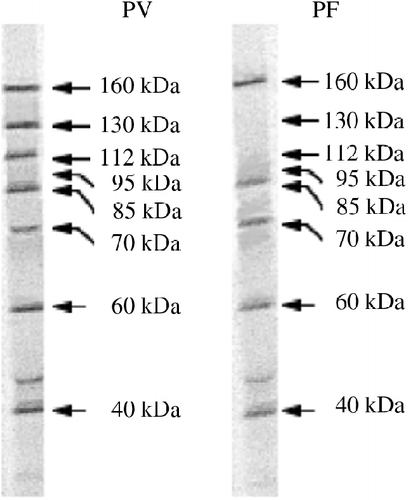 Figure 1.  Characterization of anti-keratinocyte antibody profiles of PV and PF sera by immunoprecipitation with proteins from cultures of human epidermal keratinocytes resolved by 7.5% SDS-PAGE. Modified from Ref. Citation[18].