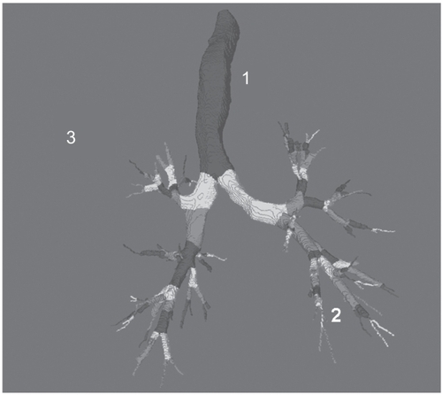 Figure 1 Computed tomography-derived human tracheo-bronchial tree. In the trachea (site 1) three types of cells may execute the function of stem cell, including basal cells, secretory cells and neuro-endocrine cells. In the bronchial and bronchiolar compartment (site 2) suprabasal, basal and Clara cells have similar abilities. In the bronchiolar-alveolar compartment (site 3), type II pneumocytes and bronchoalveolar stem cells may function as stem cell.