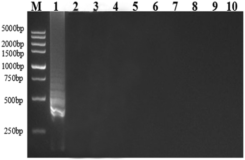 Fig. 2 Specificity of RT-LAMP for PepMoV detection. Lane 1, PepMoV; Lane 2–3, PVY; Lane 4–5, CRSV; Lane 6–7, ChiVMV; Lane 8–9, PVMV; Lane 10, non-template control. Lane M, 5 kb DNA ladder (Vazyme).