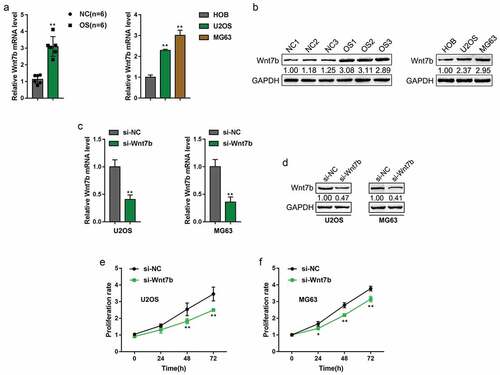 Figure 1. Wnt7b expression is upregulated in osteosarcoma and promotes OS cell proliferation