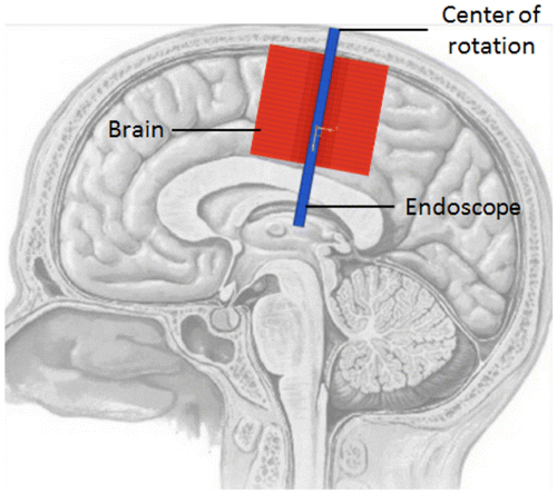 Figure 1. Personalized position of the model: mesh of the endoscope (blue) and the surrounding cerebral layer (red). The center of rotation of the endoscope (CR) corresponded to the enter point in the head. (Adapted from Netter Citation2002).