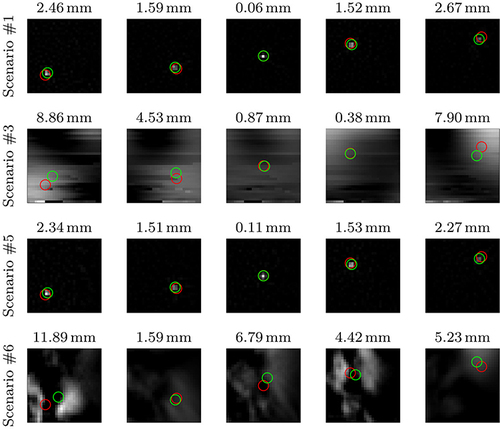 Figure 4 Selection of reconstructed images of four scenarios (sorted in rows). The calculated centers of mass and ground truth positions are indicated with green and red circles, respectively. The Euclidean distance between the positions is given in the title. The stent position is depicted clearly when being crimped on a catheter (top row). The MAE of 1.49 mm is lower than the spatial resolution of the image, which is 2 mm in both directions. The MAE is higher for the expanded stent (to 16 mm, second row), MAE = 3.70 mm, and the stent is not depicted well in the reconstructed images. As the expanded stent covers a large area of the FOV, an artefact-like reconstruction is plausible. The positions of the whole delivery system (outer blue and inner white part, third row) are depicted with an MAE = 1.46 mm. When imaging only the outer blue part of the delivery system (bottom row), the MAE increases to MAE = 6.78 mm and the reconstructed images do not represent the delivery system well. However, based on the calculated centers of mass (see Figure 3), a rough estimate of the delivery system’s position would still be possible. Note that the reconstruction parameters have been tuned to get the best result in terms of MAE between the ground truth position of the sample and the center of mass of the reconstructed images, which might decrease the image quality.