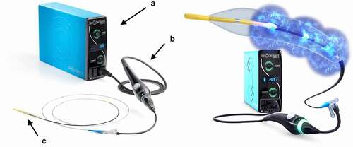 Figure 2. Coronary IVL system; (A) generator, (B) connector cable and (C) catheter. (modified images with permission from shockwave medical Inc.).