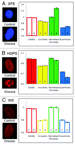 Figure 2. Feature space analysis of nuclei in aging disorders. Segmented nuclei were analyzed for shape factors (Table 2), and perimeter was normalized to the average perimeter of the corresponding control group. (C and D) indicate control and disease groups, respectively. Bars are color-coded by the parameters. Solid bars indicate that the control and disease groups are statistically different, and outlined bars indicate that they are statistically similar based on a confidence of p < 0.01. The error bars represent the standard error of the mean. Representative images of each group are shown on the left of the graph, all to scale. (A) Nuclei in cells from the Ercc1−/− mice, a model of XPE, showed altered circularity, perimeter and eccentricity. (B) HGPS patient cell nuclei at passage 22 showed differences in all features. (C) WS cell nuclei showed no differences to control nuclei.