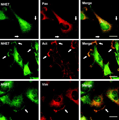 Figure 2.  NHE7 colocalizes with actin and vimentin in focal complexes of migrating MDA-MB-231 cells. Migrating MDA-MB-231 cells grown on glass coverslips were fixed and intracellular localization of NHE7, paxillin (Pax), and vimentin (Vim) were analyzed by double labeled immunofluorescence microscopy. NHE7 was visualized with Alexa 488-conjugated goat anti-rabbit antibody, and paxillin and vimentin were visualized with Alexa 568-conjugated goat anti-mouse antibody. Alexa 568 conjugated phalloidin was used to detect actin (Act). Arrows indicate co-localization signal of the plasma membrane. All the experiments were repeated three times and one set of representative results was shown. Bars, 10 µm.