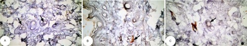 Figure 17 Photomicrographs of immunohistochemically stained breast tissue sections showing the effect of Ulva lactuca polysaccharides on antiapoptotic marker bcl-2 expression (indicated by the arrows) in DMBA-administered rats (A, B, and C; ×400).