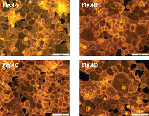 Figure 4.  Cytoskeleton organization and reciprocal direct interactions of 10.014 pRSV-T human normal corneal cells. The control sample (A), after incubation with extracts at 125 µg/ml concentration: ethanol extract (B), ethyl acetate extract (C) and heptane extract (D). TRITC-phalloidin fluorescent staining. Magnification 400×. Bar 50 µm.