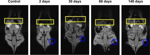 Figure 3 Typical series of MRI images of a Wistar rat treated with 50 mg/kg of cat-USPIOs as a function of time from zero up to 140 days after IV administration, highlighting the contrast in liver and spleen.Notes: The negative contrast in the left thigh is due to the accumulation of cat-USPIOs induced by a magnet placed on that local for 2 hours after IV injection. The liver and the spleen are indicated by a yellow rectangle; and a blue circle indicates the negative contrast in the thigh.Abbreviations: cat-USPIOs, cationic ultrasmall superparamagnetic iron oxide nanoparticles; MRI, magnetic resonance imaging; IV, intravenous.
