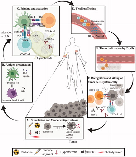 Figure 2. In situ vaccination can modulate tumor microenvironments to induce anti-tumor immune responses at multiple levels in the cancer immunity cycle. (A) ISV with immune adjuvant can cause local tissue damage, inducing immunogenic cell death and release of cancer cell antigens; and/or directly introduce PAMPs and/or DAMPs with TLR agonists or NPs into the tumor to (B) attract and activate dendritic cells and other antigen-presenting cells, (C) which mature and migrate from primary tumor to stimulate the priming and activation process of T cells in the tumor-draining lymph nodes. (D) Once primed and activated, T cells will then traffick to and (E) infiltrate solid tumors and metastases to (F) directly kill the tumors with granzymes and perforins. Multiple ISV strategies can be combined to achieve stronger anti-tumor immune response. ICD: immunogenic cell death. TAAs: tumor associated antigens. Immune adjuvants: injection of immune stimulating reagents. DAMPs: danger-associated molecular pattern molecules. PAMPs: pathogen associated molecular pattern molecules. HIFU: high intensity focused ultrasound. TLR: toll like receptor. NP: nanoparticles. Adapted from Chen and Mellman [Citation52].