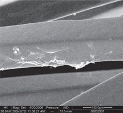 Figure 4. OECs-seeded uncoated stent under the SEM (×300).