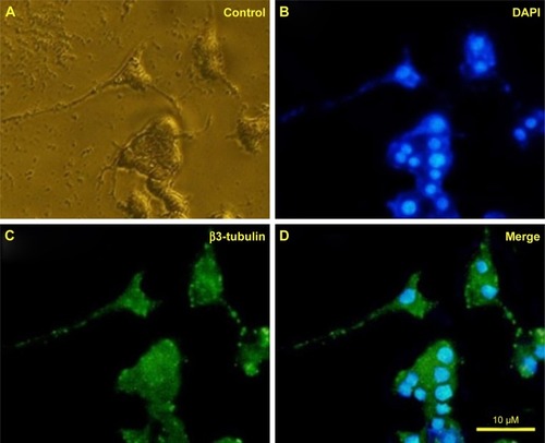 Figure 9 Immunofluorescence images of differentiated PC12 cells 5 days after treatment with iron oxide nanoparticles. (A) Control, (B) cells stained with DAPI, (C) cells stained with β3-tubulin, and (D) the merge of (B) and (C). Green and blue fluorescence represent β3-tubulin and nucleus, respectively. Nuclei marked with DAPI.