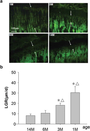 Figure 1. (a) Representative fluorescence micrographs of G-Int.Wi on PTM (undecalcified sections, 8 μm, 10×). 1M: 1 month old, 3M: 3 months old, 6M: 6 months old, 14M: 14 months old. Arrows point to interlabel width after fluorochrome labeling with tetracycline hydrochloride and calcein. The interlabel width in the growth plate for 1-month-old rats was obviously wider than that for other groups, and it declined progressively with increasing age and was narrowest for 14-month-olds. The interlabel width in the growth plate was used to determine LGR. Quantitative measurements of LGR are shown in Figure 1b. (b) Changes of LGR in different ages rats. Data are expressed as means ± SD (n = 6) in each group. LGR was significantly increased in 1- and 3-month-old rats vs. 6- and 14-month-old rats, respectively, and with no differences for 6-month-old rats versus 14-month-old rats. Vs. 14-month-old,*P < 0.01; vs. 6-month-old, ▵P < 0.01, Student’s t-test. PTM, the proximal tibial metaphyses; LGR, longitudinal growth rate; G-Int.Wi, interlabel width in growth plate; 1M: 1-month-old, 3M: 3-month-old, 6M: 6-month-old, 14M: 14-month-old.