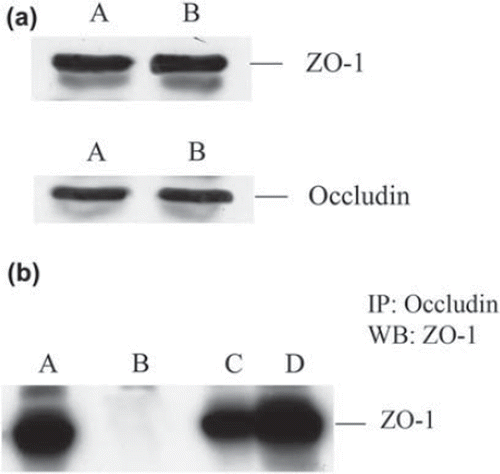 Figure 1. (a) ZO-1 and occludin protein expression after TFF3 stimulation. Lysate from control (A) and TFF3-treated (B) monolayers were resolved by sodium dodecyl sulphate polyacrylamide gel electrophoresis. No changes in total protein levels were observed after TFF3 treatment. (b) Association of ZO-1 with occludin after TFF3 stimulation. Immunoprecipitation was performed with anti occludin antibody (Zymed) and precipitated proteins were examined by Western analysis. Compared to control (C), an increase in the total proportion of ZO-1 precipitated with occludin was observed after stimulation with TFF3 (10−9 M) (D). A: ZO-1 lysate only; B: beads only.