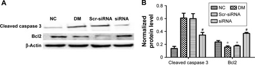 Figure 7 Mechanism of HMGB1 siRNA against cell apoptosis induced by high glucose.Notes: *P<0.05 versus NC group, #P<0.05 versus Scr-siRNA group. (A) Western blot detection. HMGB1 siRNA inhibited high-glucose-induced cleaved caspase 3 and promoted Bcl2 expression in HRECs. (B) Quantification of A. Protein expression was normalized to β-actin.