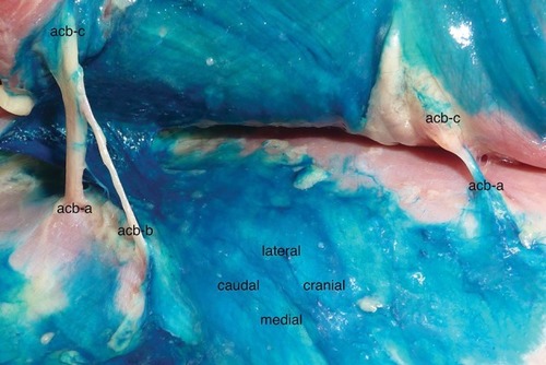 Figure 2 Anterior cutaneous branches (acb) impregnated by the dye (injection from lateral).