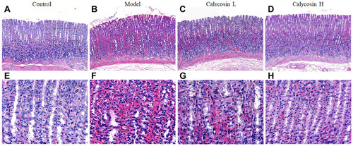 Figure 4 Effects of calycosin on histopathological changes in the gastric mucosa of PLGC rats. (A and E) Histopathological changes of gastric mucosa in the control group (H&E staining, 10×, 40×). (B and F) Histopathological changes of gastric mucosa in the model group (H&E staining, 10×, 40×). (C and G) Histopathological changes of gastric mucosa in the calycosin low group (H&E staining, 10×, 40×). (D and H) Histopathological changes of gastric mucosa in the calycosin high group (H&E staining, 10×, 40×).