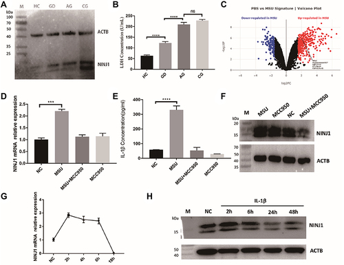 Figure 1 Elevated NINJ1 expression and PMR in gout patients. (A) Western blot of NINJ1 protein in PBMCs that isolated from different groups. (B) LDH levels in the plasma of different groups. (C) DEGs in MSU stimulated BMDMs. (D) RT-PCR of NINJ1 expression in PBMCs that stimulated with indicated reagents. (E) ELISA test of supernatant IL-1β in PBMCs that stimulated with indicated reagents. (F) Western blot of NINJ1 protein in PBMCs that stimulated with indicated reagents. (G) RT-PCR of NINJ1 expression in IL-1β treated PBMCs. (H) Western blot of NINJ1 protein in IL-1β treated PBMCs. Data are shown as mean± SEM. *** P<0.001, **** P<0.0001.