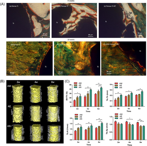 Figure 5 Evidence of 3D implants with nanoscale surface promoting osseointegration. (A) Histology images after 4 weeks (a, b, c) and 10 weeks (d, e, f) where signs of osteoid like new bone formation could be seen in Orange/ red color; Reprinted from Ann Biomed Eng, Vol 45(1), Bandyopadhyay A, Shivaram A, Tarafder et al, In Vivo Response of Laser Processed Porous Titanium Implants for Load-Bearing Implants, 249–260, Copyright © 2017, with permission from SNCSC.Citation36(B) Micro-CT reconstructed 3D models at 2, 4, and 8 weeks; (C) Quantitative analysis of Micro-CT: bone volume/tissue volume (BV/TV), trabecular thickness (Tb.Th), trabecular number (Tb.N) and trabecular separation (Tb. Sp) (*p < 5%, **p < 1%). Reprinted from Mater Sci Eng C, Vol 118, Ren B, Wan Y, Liu et al, Improved osseointegration of 3D printed Ti-6Al-4V implant with a hierarchical micro/nano surface topography: An in vitro and in vivo study, 111,505, Copyright © 2021, with permission from Elsevier.Citation35