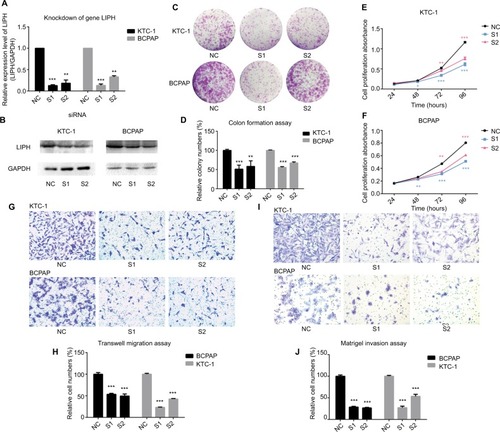 Figure 2 Knockdown of LIPH expression level restrained cell colony formation, proliferation, migration, and invasion in PTC cell lines.Notes: (A) In KTC-1 and BCPAP, the relative expression levels of LIPH were significantly knocked down by siRNA (si-LIPH) in comparison with the negative control group (si-NC) according to the qRT-PCR (two-tailed Student’s t-test, **P<0.01, ***P<0.001). (B) The corresponding protein expression levels of LIPH knockdown by siRNA in KTC-1 and BCPAP. (C) Colony formation assay: S1 and S2 formed fewer colonies than NC. (D) The columns represent the mean colony numbers for each group from at least three independent experiments, and the vertical bars on top of the columns represent SD (two-tailed Student’s t-test, **P<0.01, ***P<0.001). (E, F) CCK-8 assay: cell proliferation was significantly restrained in S1 and S2 in comparison with NC (two-tailed Student’s t-test, *P<0.05, **P<0.01, ***P<0.001). (G) Transwell migration assay: in both KTC-1 and BCPAP, S1 and S2 had fewer migrating cells than NC. (H) The columns represent the mean migrating cell numbers for each group from at least three independent experiments, and the vertical bars on top of the columns represent SD (two-tailed Student’s t-test, ***P<0.001). (I) Matrigel invasion assay: in both KTC-1 and BCPAP, S1 and S2 had fewer invading cells than NC. (J) The columns represent the mean invading cell number for each group from at least three independent experiments, and the vertical bars on top of the columns represent SD (two-tailed Student’s t-test, ***P<0.001). Magnification ×400.Abbreviations: CCK-8, Cell Counting Kit-8; GAPDH, glyceraldehyde-3-phosphate dehydrogenase; LIPH, lipase H; PTC, papillary thyroid carcinoma; NC, non-specific siRNA control group; qRT-PCR, quantitative reverse transcription PCR; S1, S2, experimental groups; si-LIPH, LIPH with siRNA knockdown.