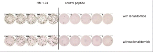 Figure 4. Representative EliSpot-analysis. The figure shows a representative EliSpot analysis from a lenalidomide refractory patient with T cells demonstrating an enhanced antigen-specific T-cell response against the myeloma antigen HM1.24 after in vitro incubation with lenalidomide.