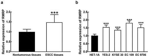 Figure 1. The expression of RMRP in ESCC. A. RMRP was significantly upregulated in ESCC tissues compared with that in adjacent nontumorous tissues. B. The expression of RMRP was dramatically higher in ESCC cell lines (YES-2, KYSE30, EC 109, and EC9706) than that in the normal esophageal epithelial cell line (HET-1A). ***P < 0.001