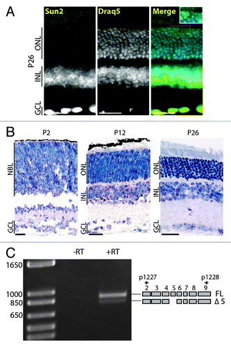 Figure 4. Expression pattern of Sun2 in the developing retina. (A) Typical Sun2 immunostaining pattern of RGC, amacrine and cones nuclei in P26 retina. Scale bars: 25µm, 5µm in inset. (B) In situ hybridization of P2 (left), P12 (middle) and P26 (right) retinas. Scale bars: 25µm. (C) Exon5, encoding a stretch of the nucleoplasmic region of Sun2, is alternatively spliced in retina.
