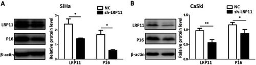 Figure 4 The effect of LRP11 silencing on P16. (A) The protein levels of LRP11 and P16 were determined by Western blotting in SiHa, as well as quantification of protein expression levels (B) CaSki protein levels, similar to that of SiHa. *P<0.05, **P<0.01, compared with the NC groups.