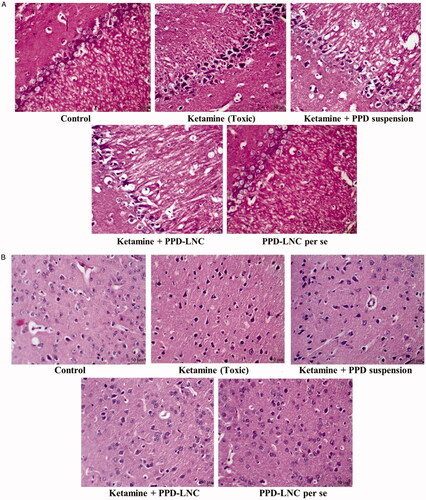 Figure 5. (A) H & E stained sections of the hippocampus in rats treated with normal saline (control), ketamine (toxic), ketamine + conventional formulation PPD suspension, ketamine + nanoformulation PPD-LNC, and PPD-LNC per se. (B) H & E stained sections of cortex in rats treated with normal saline (control), ketamine (toxic), ketamine + PPD suspension, ketamine + PPD-LNC, and PPD-LNC per se.