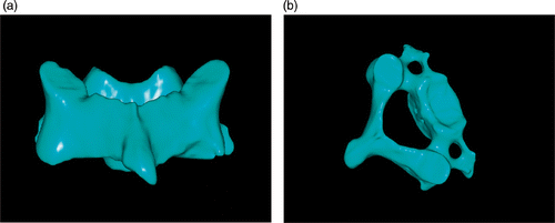 Figure 1. 3D model of the cervical vertebra. (a) Posterior view. (b) Superior view.