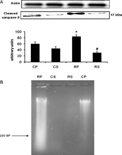 Figure 6  (A) The effect of restraint and Sutherlandia supplementation on cleavage of caspase-3 in gastocnemius muscle. Samples were analysed by western blotting with antibodies recognizing cleaved caspase-3. Results are expressed as means ± SEM for eight independent experiments, *p < 0.05 vs. CP; #p < 0.001 vs. RP, F = 13.03. CP, control placebo; CS, control Sutherlandia; RP, restraint placebo; RS, restraint Sutherlandia. (B) The effect of restraint and Sutherlandia supplementation on DNA fragmentation in gastocnemius muscle. Lane 1: DNA sample from the RP group showing a ladder pattern, lane 2: DNA samples from the CS group, lane 3: DNA samples from the RS group and lane 4: DNA samples from the CP group. CP, control placebo; CS, control Sutherlandia; RP, restraint placebo; RS, restraint Sutherlandia.