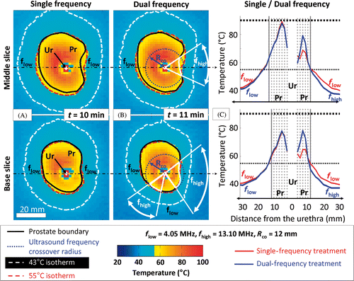 Figure 7. Comparison between single- and dual-frequency treatments in gel phantoms for 2 different slices. (a) Single 4.05 MHz high power (20 W cm−2) showing the maximum temperature reached during the treatment in 2 different slices of the segmented canine prostate profile, respectively the middle and base slices; (b) Dual 4.05/13.10 MHz mixed power (20/10 W cm−2) ultrasound exposures with a crossover radius set at 12 mm; (c) Temperature profiles along the dash dot lines shown in (a) and (b). Use of the higher frequency during rotational ultrasound exposures creates a steeper temperature gradient beyond the target boundary.