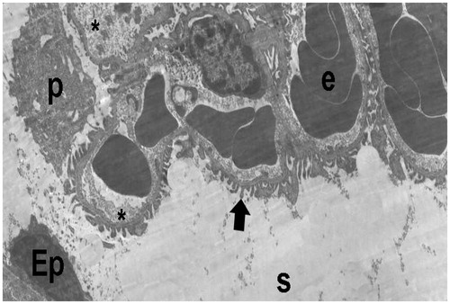 Figure 17. (Electron micrographs show Sham + aliskiren 100 mg/kg group ultrastructure). Electron micrographs showing a glomerular capillary (asterisk) with normal basal lamina and podocyte foot process (arrow head). Electron microscopic findings show typical parietal epitalial cell (Ep). Erythrocyte (e). Capillary (asterisk). Podocytes (P). Bowman’s capsular space (s). 25,000×.