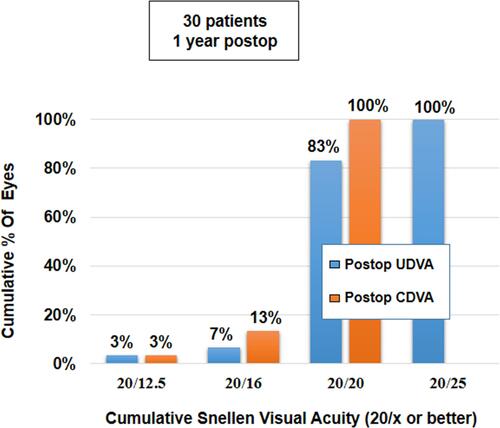 Figure 4 Histogram showing binocular cumulative visual acuity UDVA and CDVA achieved at 12 months postoperatively.