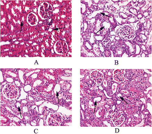 Figure 1.  Representative imagines of kidney from rats. (A) Control group: section shows normal tubules; (B) Gentamicin (100 mg/kg) treated group: tubule shows extensive and marked necrosis; (C) Gentamicin + EMO (250 mg/kg) treated group: tubules show limited damage; (D) Gentamicin + EMO (500 mg/kg) treated group: tubule reveals slight degenerative change. EMO, ethanol extract of Macrothelypteris oligophlebia rhizomes.