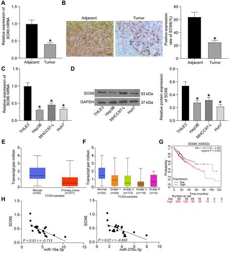 Figure 4 SOX6 is poorly expressed in HCC tissues and cells. (A) SOX6 mRNA expression in 21 cases of HCC tissues and adjacent normal tissues determined by RT-qPCR. (B) The positive rate of SOX6 protein expression in 21 cases of HCC tissues and adjacent normal tissues detected by immunohistochemical staining. (C) SOX6 mRNA expression in human normal liver cell line THLE3 and HCC cell lines (Hep3B, MHCC-97L, Huh7) determined by RT-qPCR. (D) SOX6 protein expression in human normal liver cell line THLE3 and HCC cell lines (Hep3B, MHCC-97L, Huh7) tested by Western blot analysis. (E) detection of SOX6 expression in the TCGA database. (F) detection of SOX6 expression at different stages of HCC. (G) analysis of the prognosis of patients with differential expression of SOX6. (H) correlation analysis of miR-19a-3p and miR-376c-3p with SOX6 expression in HCC tissues. The measurement data were depicted as mean ± standard deviation. Comparison between two groups was conducted by unpaired t-test or and comparisons among multiple groups were analyzed by one-way ANOVA. The experiment was repeated three times. *p < 0.05 vs adjacent normal tissues or THLE3 cells.