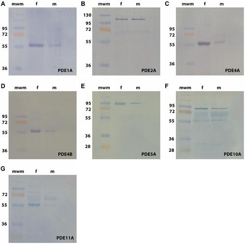 Figure 2 (A–G) Western blot analysis. Exposure to anti-PDE1A (A), -PDE2A (B), -PDE4A (C), -PDE4B (D), -PDE5A (E), -PDE10A (F) and -PDE11A (G) antibodies of cytosolic supernatants prepared from tissue specimens of the human male and female urethra displayed signals of the expected molecular weights for the PDE isoenzymes investigated: PDE1A: 65 kDa, PDE2A: 97 kDa, PDE4A/4B: 66 kDa, PDE5A: 89–99 kDa, PDE10A: 90–93 kDa, PDE11A: 65–95 kDa. mwm = molecular weight marker (Page Ruler PlusTM Protein ladder, Fermentas GmbH, St. Leon-Roth, Germany).