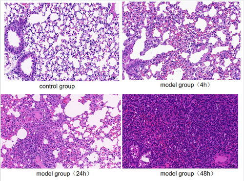 Figure 1 Pulmonary histopathology of control group and 4 h, 24 h and 48 h after infection in the model group (hematoxylin-eosin staining, ×200). Control group: not inoculated with bacteria; model group (4 h): 4 h after infection in the model group; model group (24 h): 24 h after infection in the model group; model group (48 h): 48 h after infection in the model group.