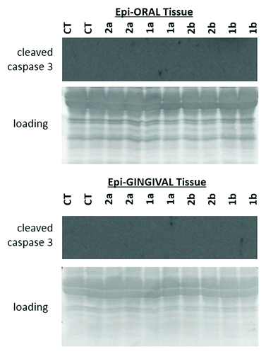 Figure 3. Levels of cleaved caspase 3 in EpiOral and EpiGingival tissues treated with 1a, 1b, 2a, and 2b antioxidants.CT, control tissues; 1a, 1b, 2a, 2b, tissues treated with antioxidants. Antioxidants: 1a, 6′-hydroxy-2′,5′,7′,8′-tetramethylchroman-2′-yl) methyl 3,4,5-trihydroxybenzoate; 1b, 6′-hydroxy-2′,5′,7′,8′-tetramethylchroman-2′-yl) methyl 3,5-dimethoxy-4-hydroxycinnamate; 2a, N-decyl-N-(3,5-dimethoxy-4-hydroxybenzyl)-3-(3,4-dihydroxyphenyl) propanamide; 2b, N-decyl-N-(3-methoxy-4-hydroxybenzyl)-3-(3,4-dihydroxyphenyl) propanamide.