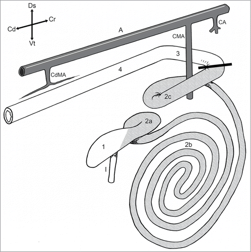 Figure 1. Schematic right lateral view of the bovine large intestinal tract. 1) Cecum; Ascending colon: 2a) Proximal loop, 2b) Spiral colon, 2c) Distal loop; 3) Transverse colon; 4) Descending colon; I) Ileum; A) Aorta; CA) Celiac artery; CMA) Cranial mesenteric artery; CdMA) Caudal mesenteric artery. The bold line shows where the atresia coli was placed. Modified from ref. 29.