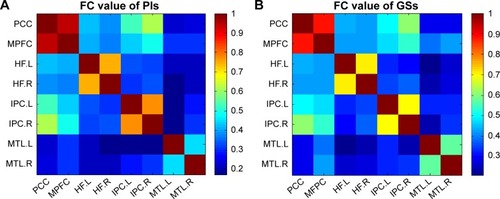 Figure 2 Correlation matrix of average time series of pair-wise subregions in DMN.