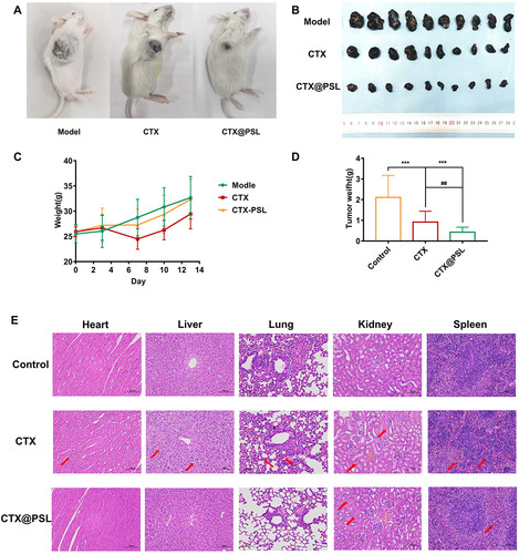 Figure 6 Therapeutic efficacy in a melanoma tumor model. (A) Melanoma growth in mice (some mice); (B) Melanoma masses exfoliated from mice; (C) Body weight gain curve of mice during treatment; (D) Inhibitory effect of CTX@PSL on the growth of melanoma in mice. All the data are presented as mean ± SD (n=10), ##p<0.01, ***p<0.001; (E) Histological sections of ICR mice. Heart: red arrows indicate enhanced cytoplasmic eosinophilia and nuclear fixation of cardiomyocytes; Liver: red arrows indicate granular degeneration of hepatocytes and balloon-like degeneration; Lungs: red arrows indicate a small amount of eosinophilic granules visible in the bronchial lumen, mild thickening of the alveolar wall and inflammatory cell infiltration; Kidney: red arrows indicate tubular epithelial cell edema and interstitial stasis of the kidney; Spleen: red arrows indicate multinucleated giant cells visible in the red pulp, in addition to a few granulocytes. HE, scale bar = 100 μm.