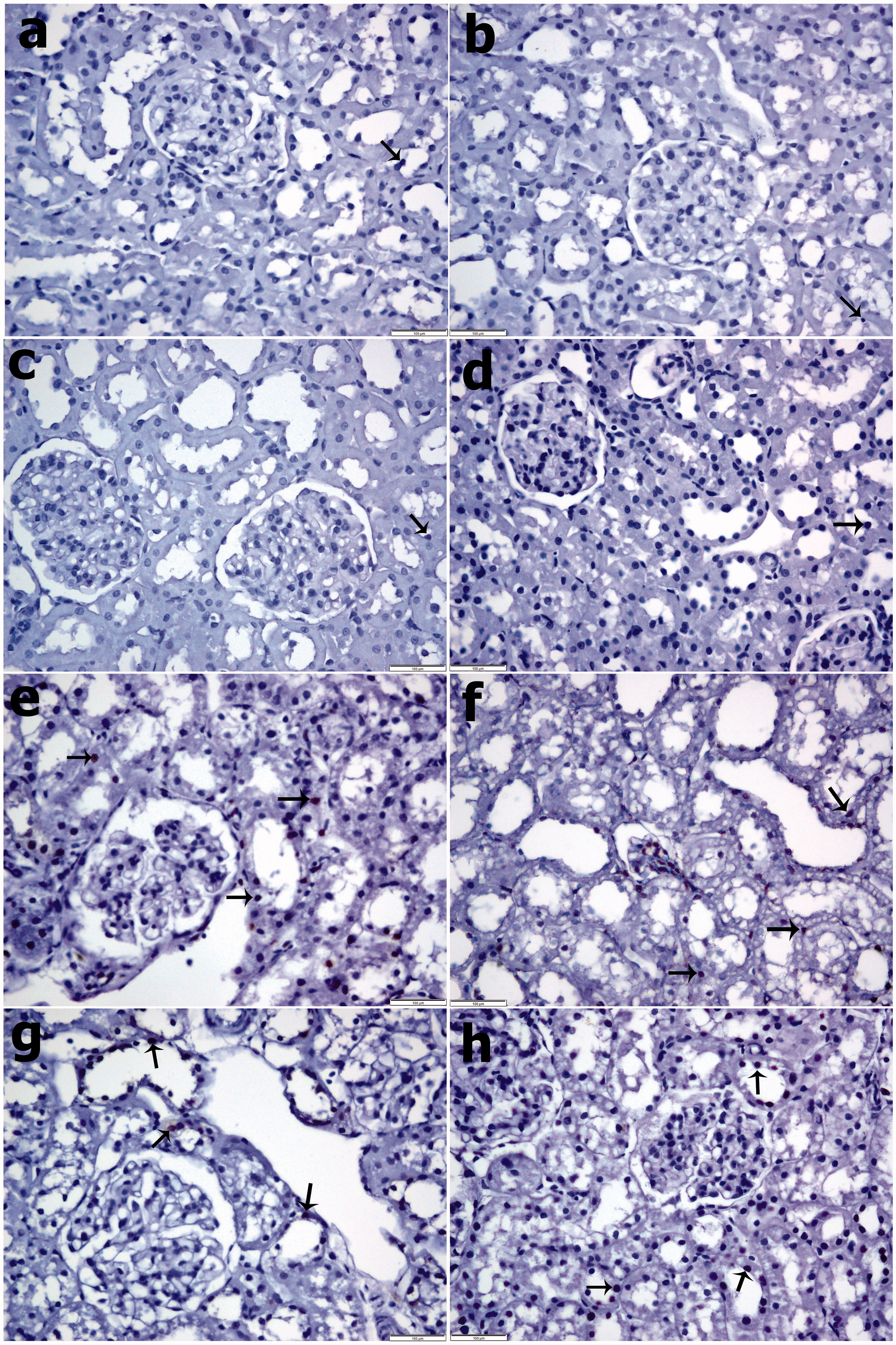 Figure 3. TUNEL staining. (a) Control group, (b) PBS group, (c) SPC2 group, (d) SPC10 group, (e) Contrast group, (f) Contrast + PBS, (g) Contrast + SPC2 group, and (h) Contrast + SPC10 group. Control, PBS, SPC2, and SPC10 groups a small number of TUNEL-positive cells were observed in the renal tissue. In the Contrast group that TUNEL-positive cells were significantly higher in the renal tissues. Contrast + SPC2 and Contrast + SPC10 groups, TUNEL-positive cells were significantly decreased in the renal compared with contrast group. (Arrows: TUNEL positive cells) (TUNEL staining, magnifications: ×400).