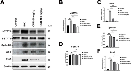 Figure 5 Effect of CUR on the signaling pathway of STAT 3 in lesion skin of the psoriasis mice. (A) The protein levels of p-STAT3, T-STAT3, Cyclin D1, Bcl-2 and Pim1 were determined by Western blotting. (B–F) Gray statistics for each protein. p, phosphorylation; T, total. *P< 0.05, **P<0.01, ***P<0.01.