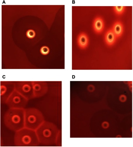 Figure 1 Hemolytic phenotype comparative analyses of Staphylococcus aureus on blood agar plates.Notes: (A) S. aureus strains with incomplete hemolytic phenotype (SIHP) strains growing in the microaerophilic condition. (B) S. aureus strains with complete hemolytic phenotype (SCHP) control strain of S. aureus ATCC25923. (C) Several SIHP colonies aggregated, forming a grid-like hemolytic phenotype. (D) SIHP strains after ten serial passages.