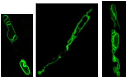 Fig. 6. Pleiomorphic vacuoles in A. oryzae.Citation23)